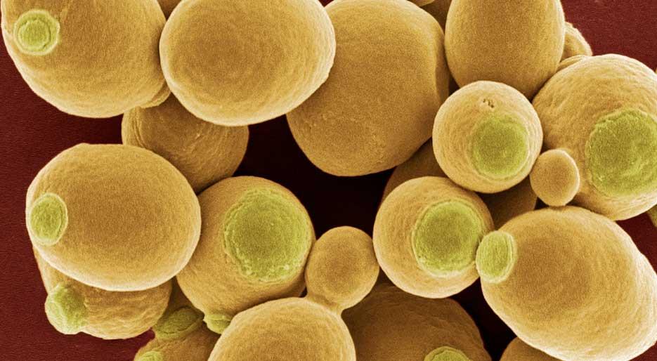 Saccharomyces cerevisiae visto al microscopio - Gluten Free Travel and Living