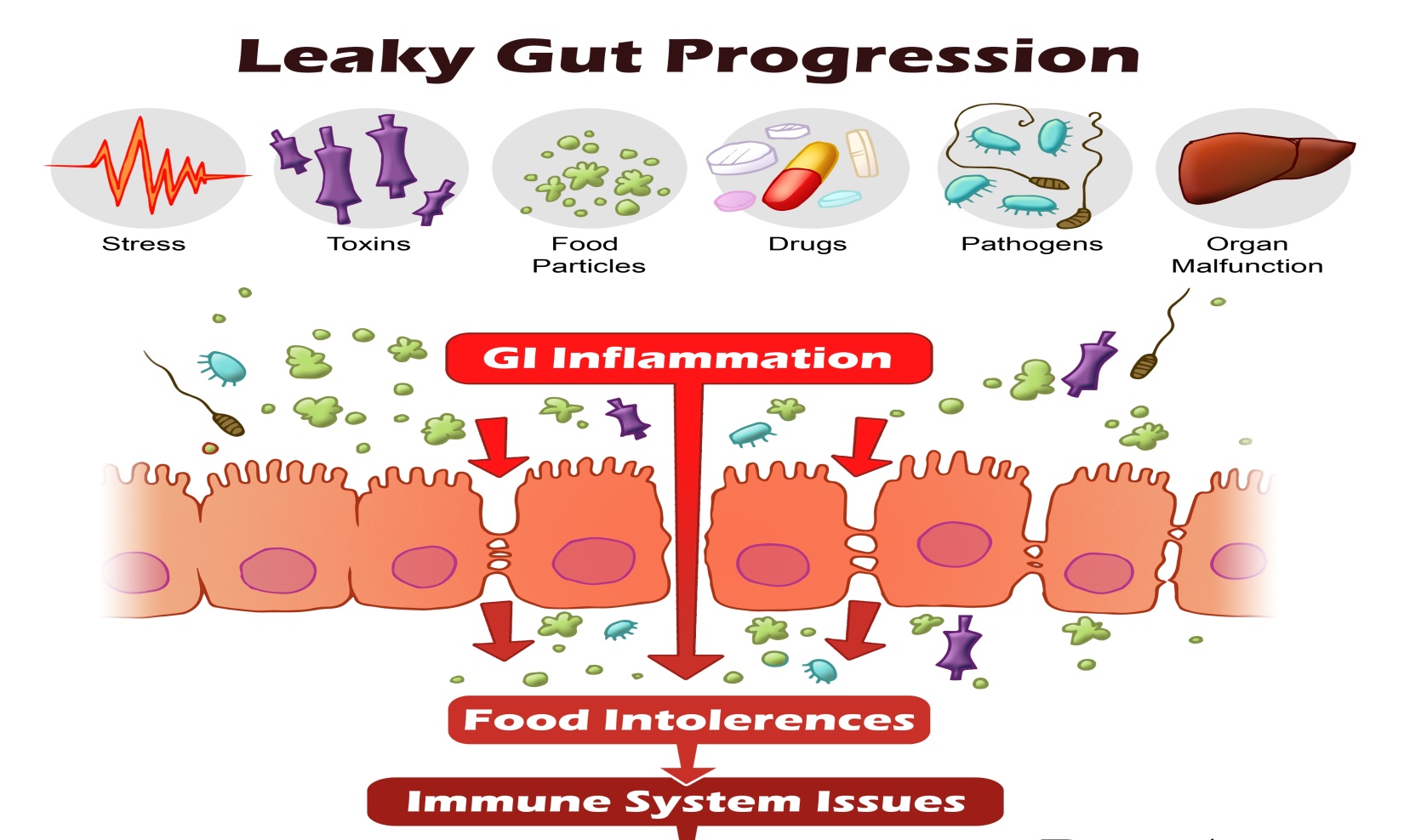 gluten sensitivity e gliadina