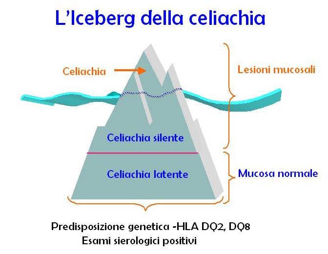 L'iceberg (semplificato) della celiachia - Gluten Free Travel and Living